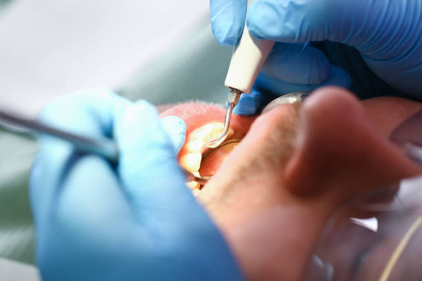 Best Urgent Tooth Repair  in Bakersfield, CA