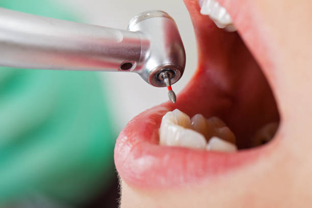 Best Emergency Tooth Extraction  in Bakersfield, CA